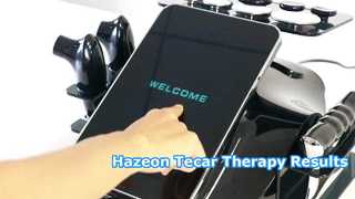 Máquina de terapia Hazeon Tecar RL-W20 – Dispositivo avançado de fisioterapia e reabilitação de 448kHz