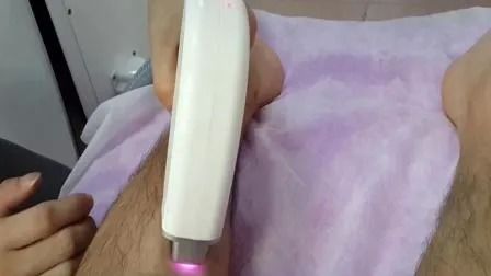 Máquina de Depilação a Laser Diodo 808nm com Energia de 1-50A e Largura de Pulso de 1-400ms para 6 Tipos de Pele